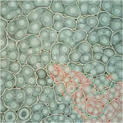 UNTITLED NO. 3, 1998 (44), London